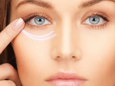 رفع پف زیر چشم