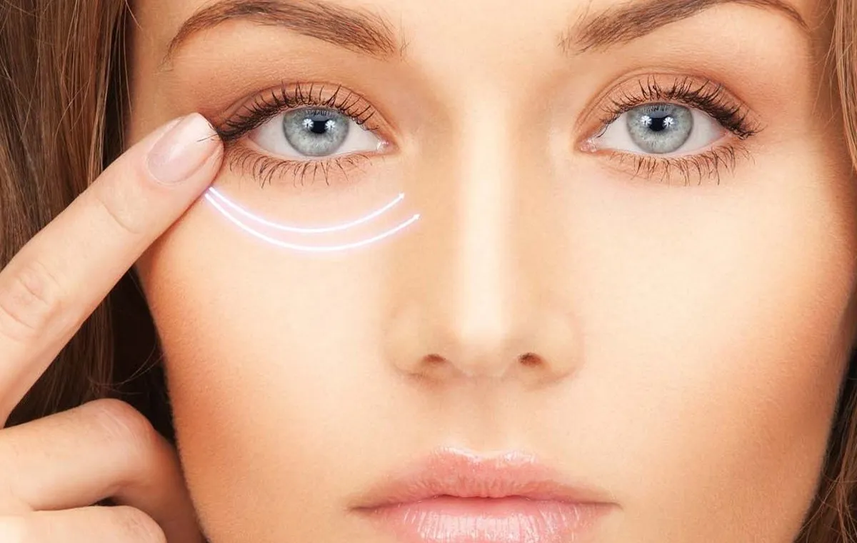 رفع پف زیر چشم